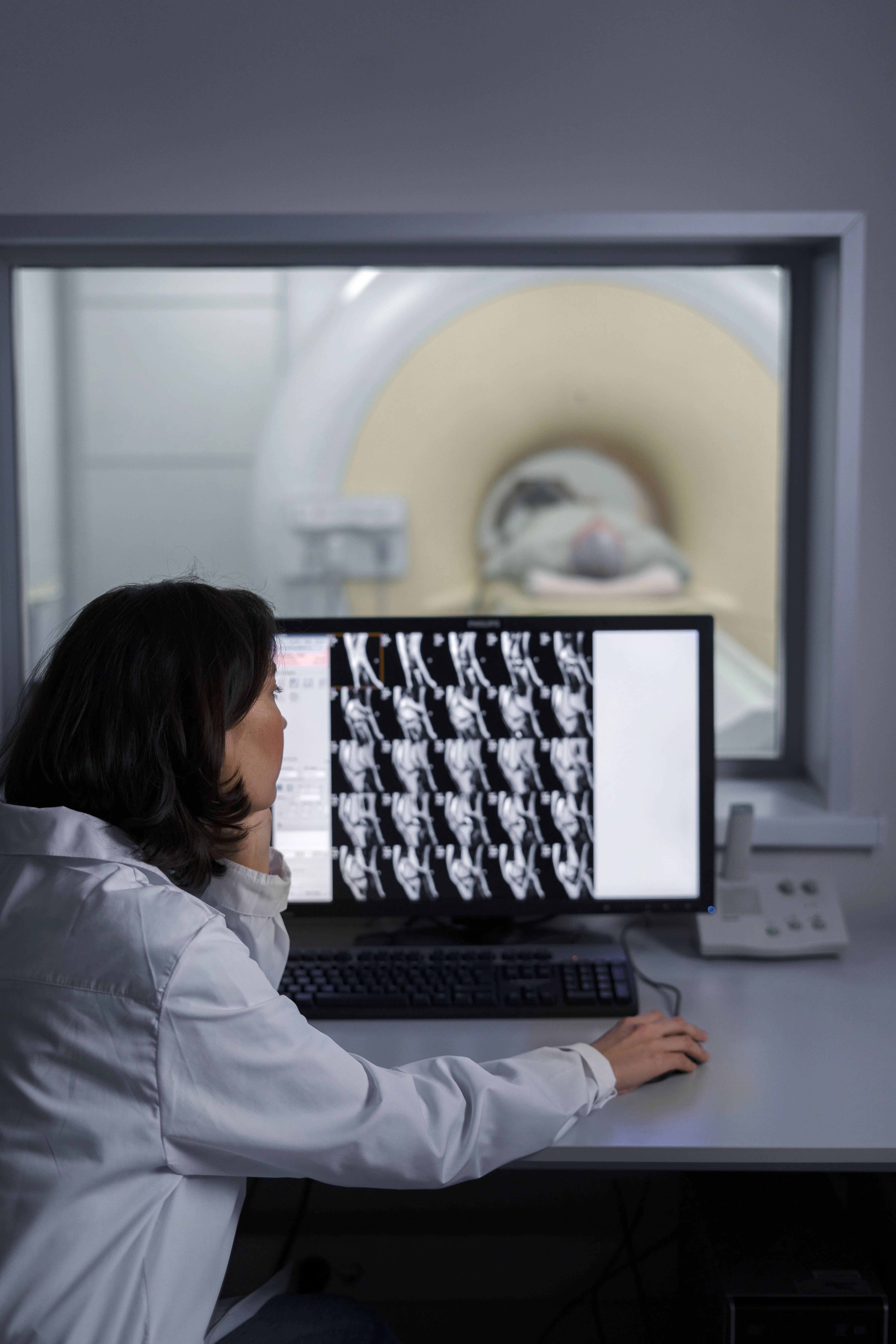 imagem 2 da Radiografia Raio-X